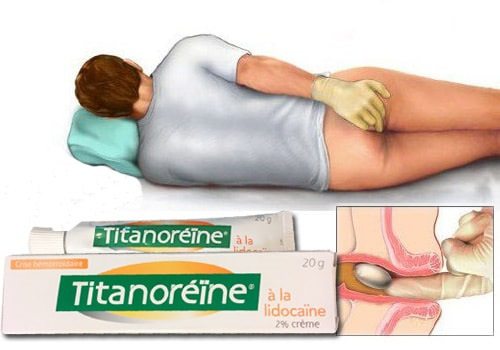 Kem bôi trị trĩ ngoại Titanoreine của Pháp 20g – duocphamhungthinh